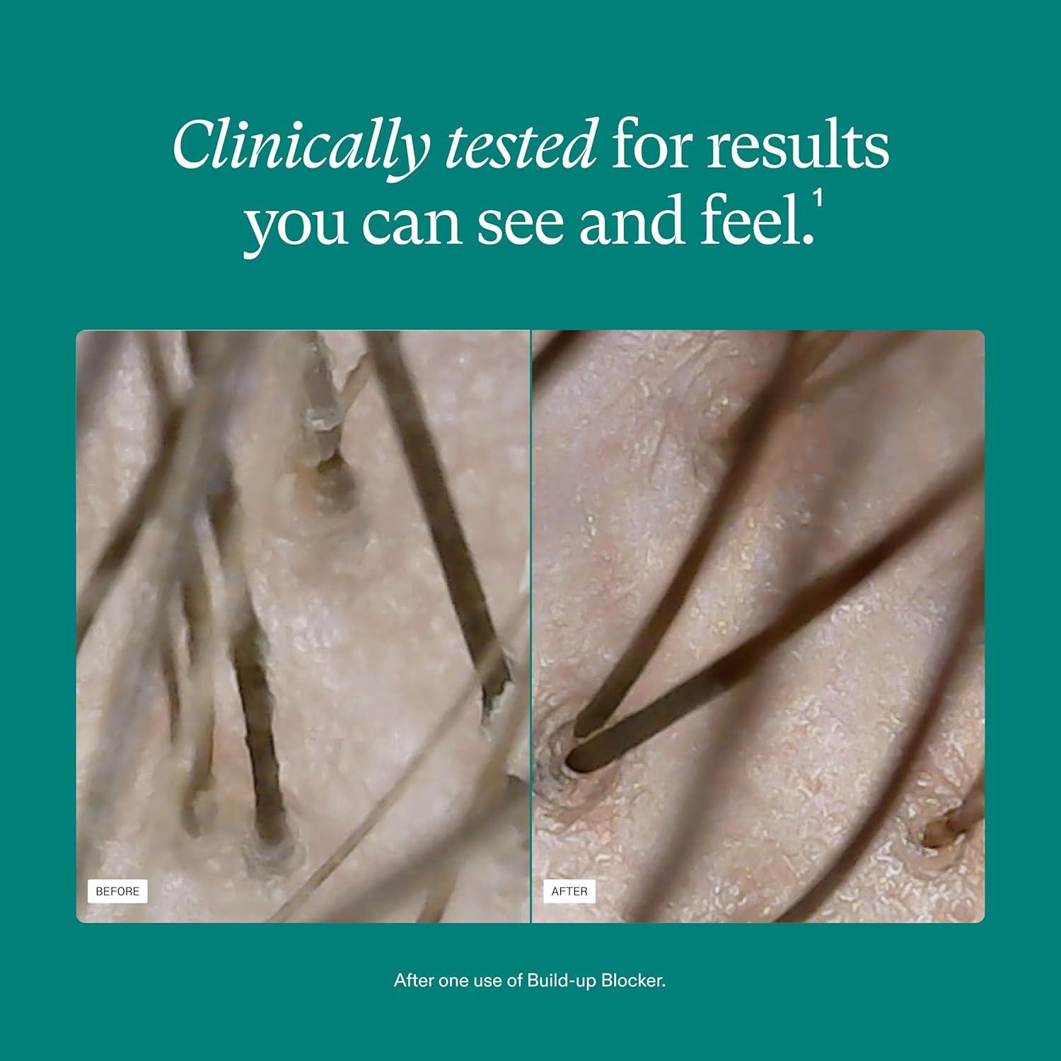 imageNutrafol Exfoliating Scalp Mask Eliminates Product Buildup and Oil for Healthier Hair and Scalp Physicianformulated for Thinning Hair Color and Extension Safe  4 Fl Oz Bottle